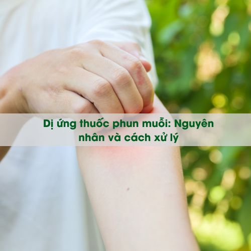 Dị ứng thuốc phun muỗi: Nguyên nhân và cách xử lý đúng cách